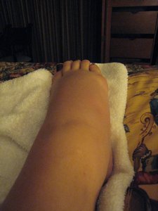 IMG 5679